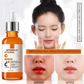 Uptown LA Vitamin C Serum bottle with before and after effects on skin